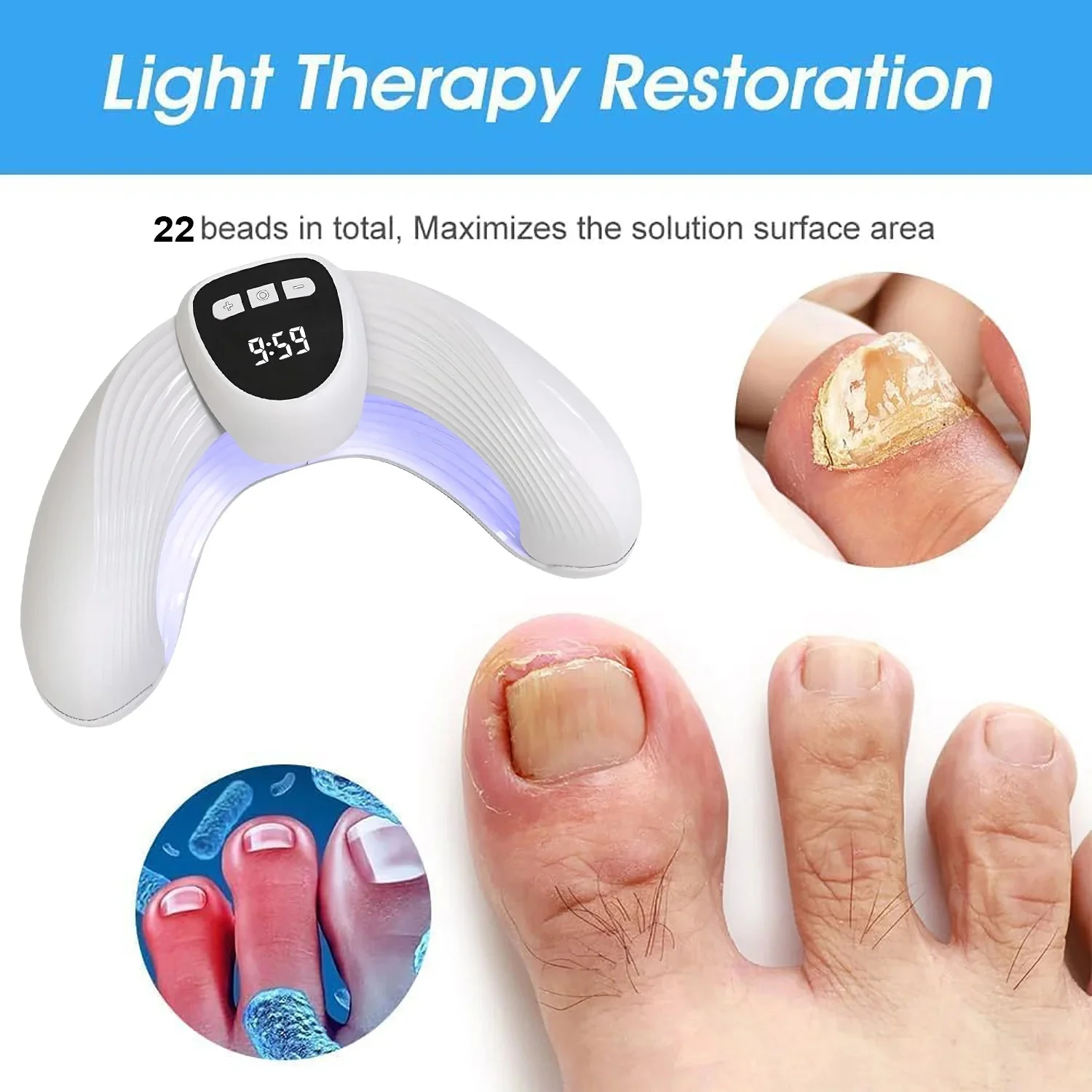 Laser Nail Fungus Treatment Device – Removes Toenail & Fingernail Fungus, Effective Onychomycosis Cure for Fungal Infections