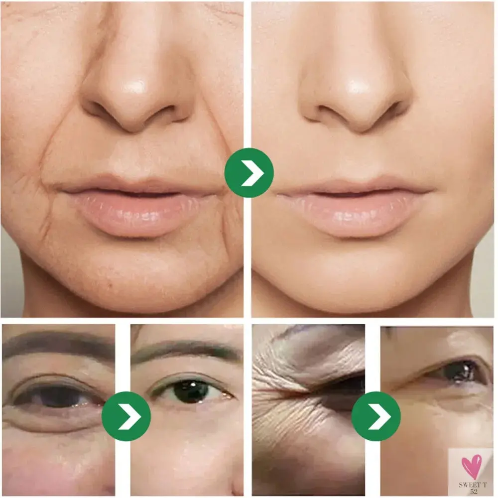 Six peptides Japanese Cream - Anti-Wrinkle Moisturizing, Anti-Early Aging for Sensitive Skin Face And Neck, Unisex